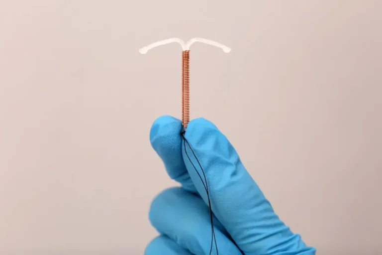 IUD birth control device